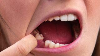 Güçlendirmiyor çürütüyor: Dişlerinizin dökülmesi an meselesi! Hemen onu bırakın