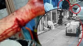 Pitbull köpeğini defalarca üzerine saldırttı! Atardamarı kopan adam: Ne oluyor diye döndüm, hiç tanımadığım kişi saldır komutu verdi