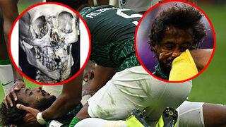 Kemikleri kırılıp, iç kanama geçirmiş! Suudi Arabistan, Lionel Messili Arjantin'i böyle devirmiş!