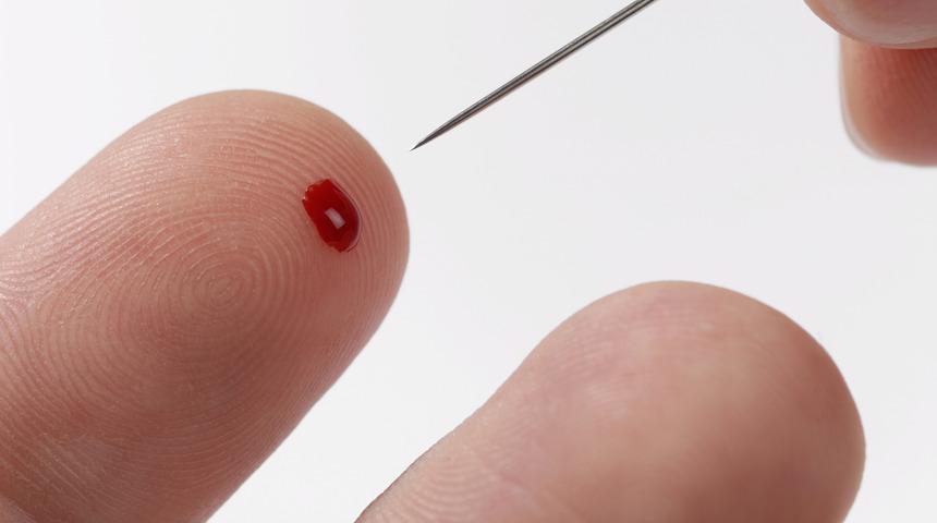 Kalp krizi ge&ccedil;iren kişiyi hayata d&ouml;nd&uuml;ren toplu iğne y&ouml;ntemi