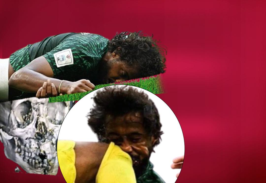 Burnu, 3 dişi, &ccedil;enesi ve y&uuml;z kemikleri kırılmıştı! İşte Suudi Arabistan'ın yıldızının son hali