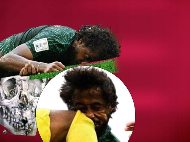 Burnu, 3 dişi, çenesi ve yüz kemikleri kırılmıştı! İşte Suudi Arabistan'ın yıldızının son hali