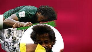 Burnu, 3 dişi, çenesi ve yüz kemikleri kırılmıştı! İşte Suudi Arabistan'ın yıldızının son hali