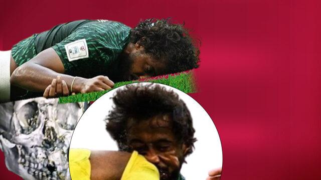 Burnu, 3 dişi, çenesi ve yüz kemikleri kırılmıştı! İşte Suudi Arabistan'ın yıldızının son hali