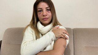 Barışmak için geldi, 4 aylık hamile eşine 2 yaşındaki çocuğunun gözü önünde dehşeti yaşattı! 