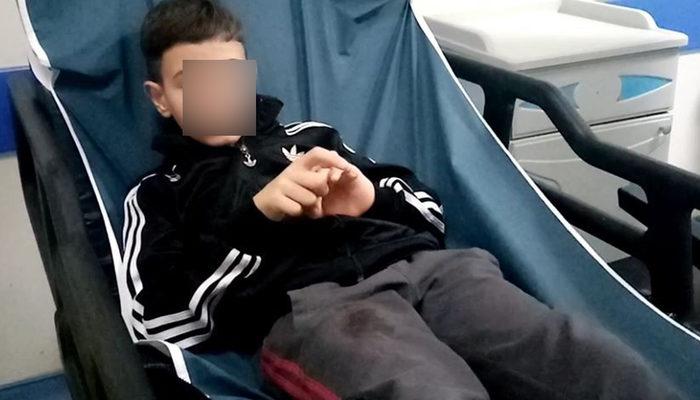 Tekirdağ’da pitbull dehşeti: 10 yaşındaki çocuğu bacağından ısırdı