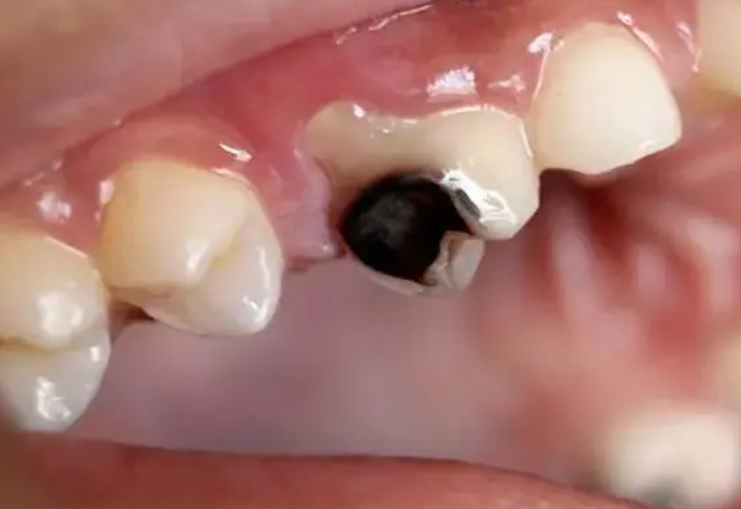 Verdiği acı dayanılmaz! &Ccedil;&uuml;r&uuml;kleri &ouml;nlemenin yolu &ccedil;ok basit 