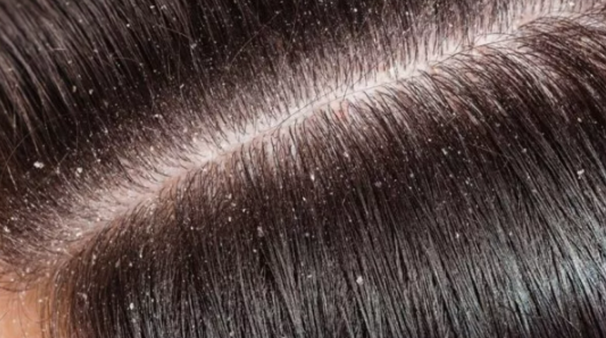 Hemen mutfağa koşun! Saçlarınız hiç olmadığı kadar sağlıklı gözükecek: Neden şampuanınıza şeker eklemelisiniz?