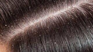 Hemen mutfağa koşun! Saçlarınız hiç olmadığı kadar sağlıklı gözükecek: Neden şampuanınıza şeker eklemelisiniz?