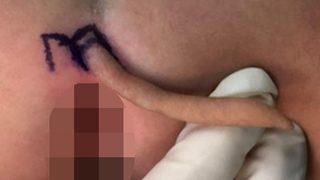 Milyonda bir görülüyor! Kuyruğuyla dünyaya gelen kız bebek görenleri şaşkına çevirdi... “Son derece nadirdir”