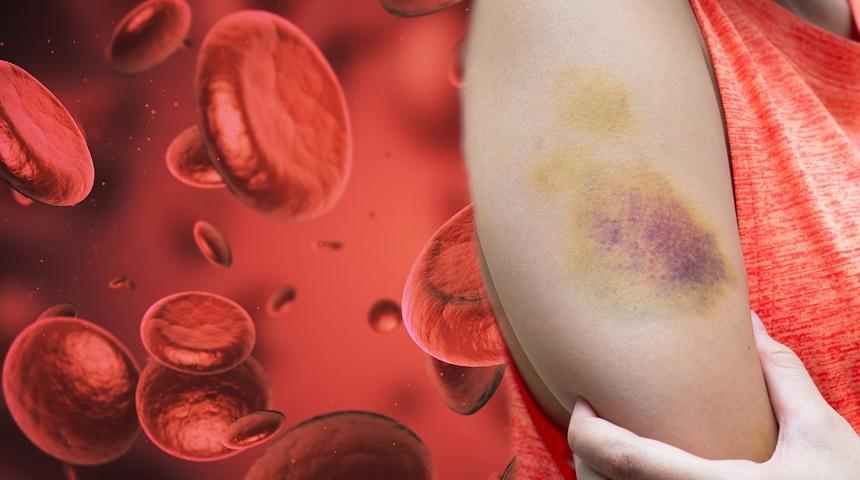 Vücudunuz imdat sinyali veriyor! Bu görüntü çok tehlikeli