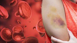 Vücudunuz imdat sinyali veriyor! Bu görüntü çok tehlikeli