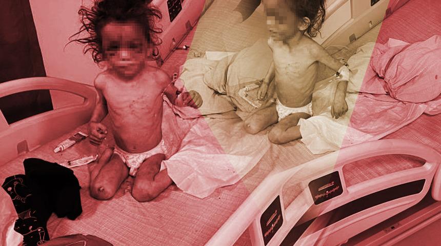 Böyle anne olmaz olsun! 5 yaşındaki kız çocuğunu aç bırakıp, işkence yaptı; eve gelen baba şoke oldu