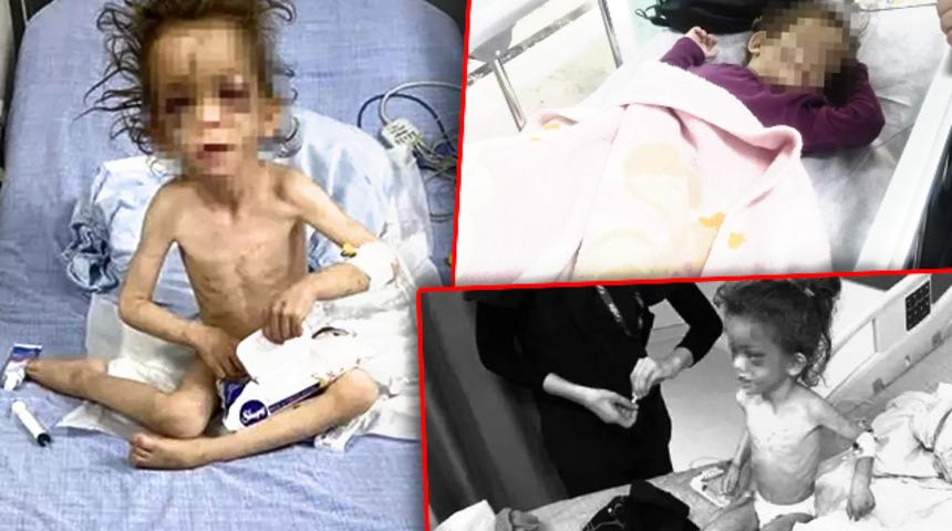 Son dakika | Gaziantep'te küçük çocuğa yapılan işkence yürekleri parçalamıştı! Flaş gelişmeyi Bakan Yanık duyurdu: 3 kardeş koruma altında