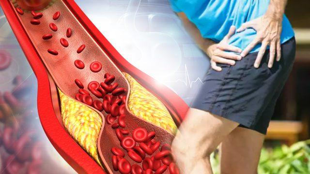 Her şey bu belirtiyle başlıyor: Görmezden gelmeyin! Tehlikeli hastalığı erken teşhis edin