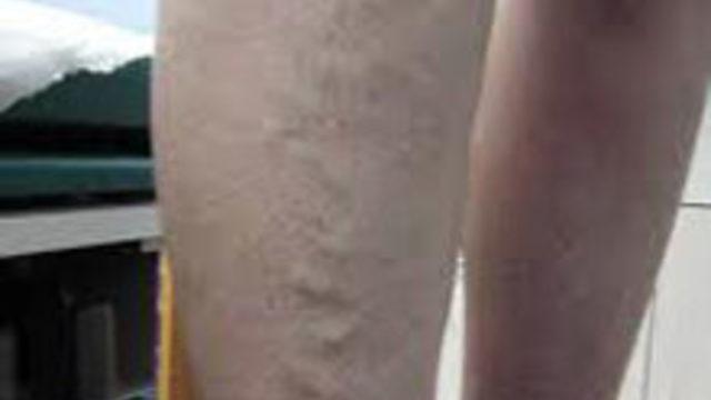 Çalışanlar Bu Sinsi Hastalığa Dikkat!