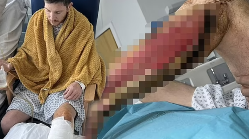 Amatör futbolcu neredeyse bacağını kaybediyordu! Kimse bu riskin farkında değil