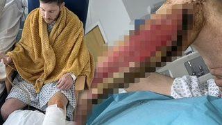 Amatör futbolcu neredeyse bacağını kaybediyordu! Kimse bu riskin farkında değil