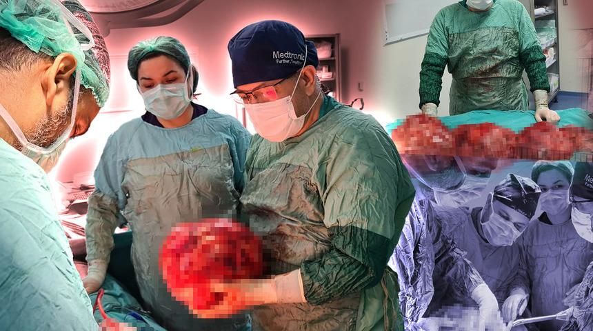 Kilo aldığını sanıp diyete girdi! Gerçek, muayenede ortaya çıktı: 1 değil, 2 değil, 3 değil, 4 tane... "Bir anda zayıflamış olduk"