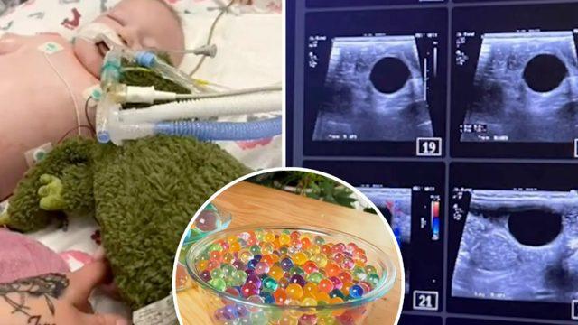 Tehlike hâlâ devam ediyor! Su maymunu yutan bebek neredeyse ölüyordu