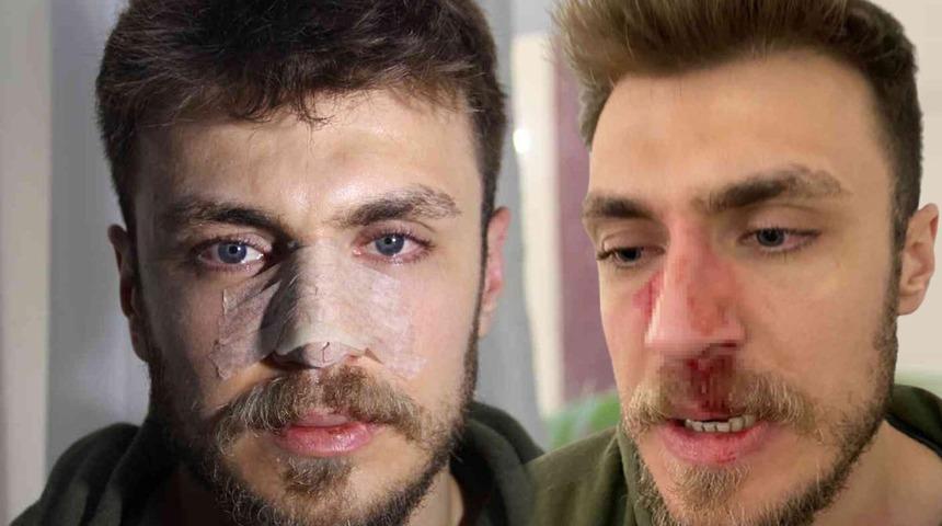 Bir gün arayla iki dehşet! Önce “Nasıl muayene etmezsin?” diye sonra “Eşimi nasıl muayene edersin?” diye… Kadın doktor isteyip erkek doktorun burnunu kırdı