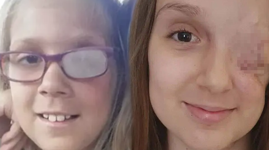 Her şey göz tembelliğiyle başladı! Göz çukuru alındıktan sonra hayatını kaybetti