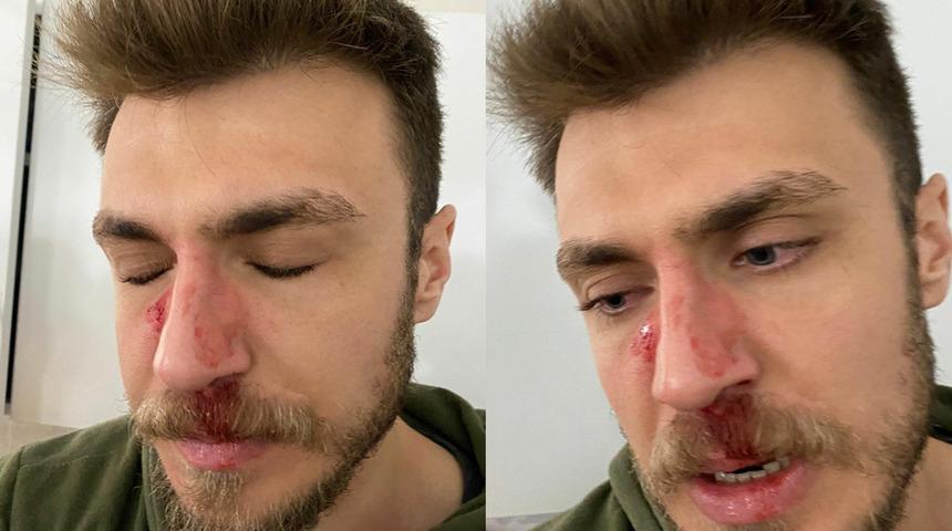 'Erkek doktor istemiyorum' deyip darp etmişti! Doktor kafa travması geçirmiş