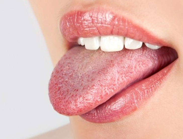 Dilinizde bu durumu yaşıyorsanız doktora koşun! Kanserin az bilinen belirtisi G3
