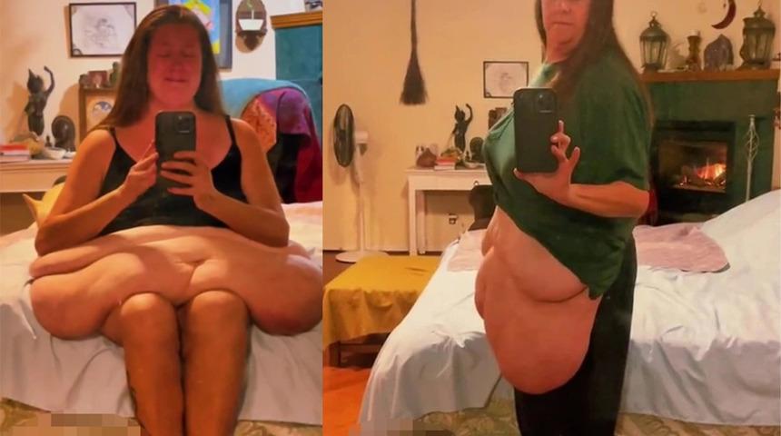 Tam 272 kiloydu! 167 kilo veren kadının değişimi şoke etti... “Kendimi hayatımı kurtarmak istedim”