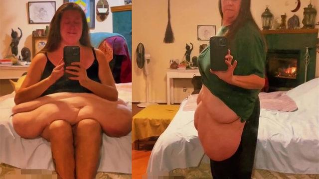 Tam 272 kiloydu! 167 kilo veren kadının değişimi şoke etti... “Kendimi hayatımı kurtarmak istedim”