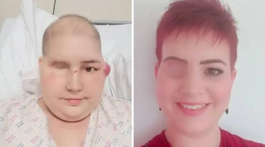 Herkes onu konuşuyor: Dünyada bir ilk! Cesedi televizyonda parçalara ayrıldı