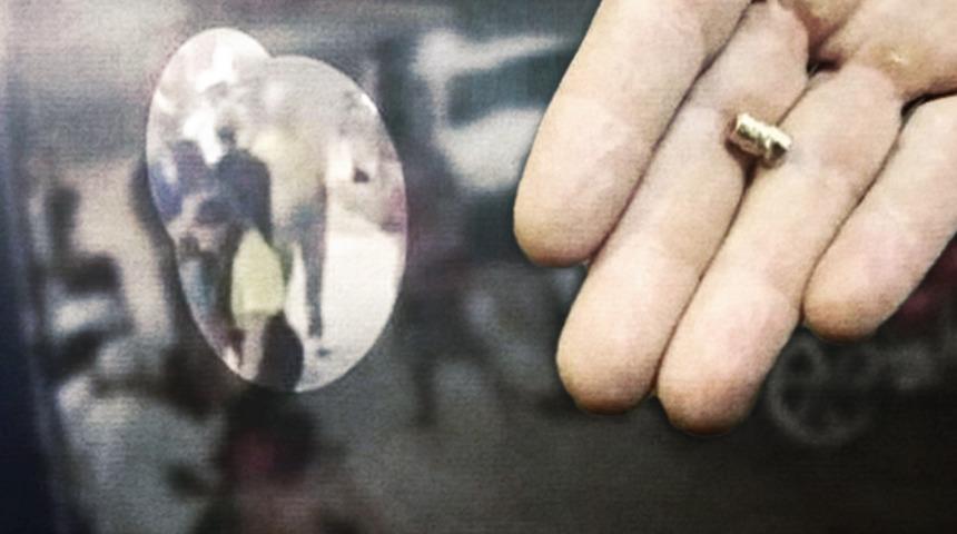 'Mucize adam'! Beynini delip geçmesi gereken kurşun ağzından çıkarıldı