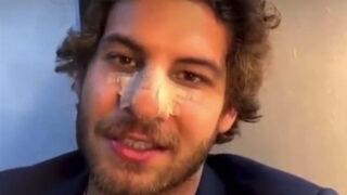 Mustafa Mert Koç'tan estetik açıklaması! Şevval Sam'ın oğlu Tarık Emir Tekin kırmış