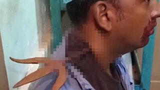 Görenler bakmaya bile tahammül edemedi! Boynundan bıçaklanan adam mucizevi şekilde hayatta kaldı... “Canım acımıyor” 