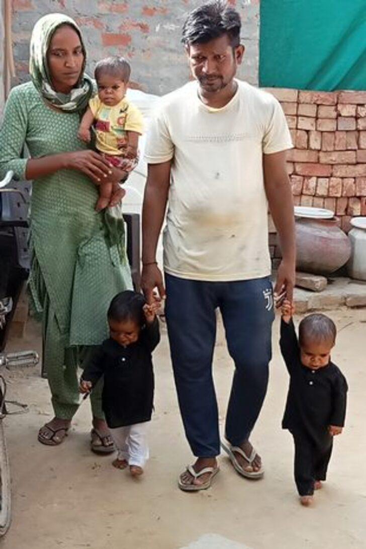 Bir gören bir daha bakıyor! Üç kardeşin gizemli hastalığı herkesi şaşkına çevirdi... Boyları 20 cm olarak kalacak G4