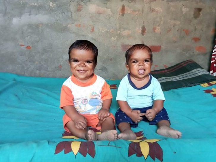 Bir gören bir daha bakıyor! Üç kardeşin gizemli hastalığı herkesi şaşkına çevirdi... Boyları 20 cm olarak kalacak G5