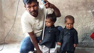 Bir gören bir daha bakıyor! Üç kardeşin gizemli hastalığı herkesi şaşkına çevirdi... Boyları 20 cm olarak kalacak