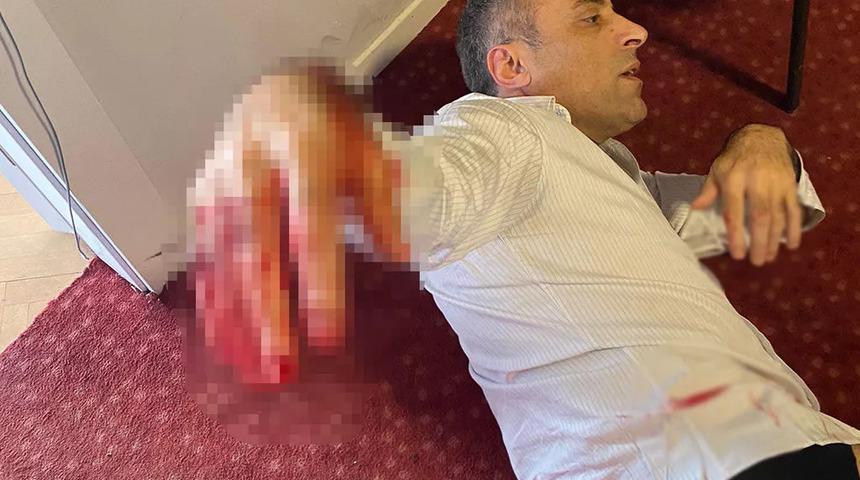 Son dakika: Yenilik Partisi Genel Başkanı Yılmaz'a bıçakla saldırmıştı! O şüpheli adliyeye sevk edildi