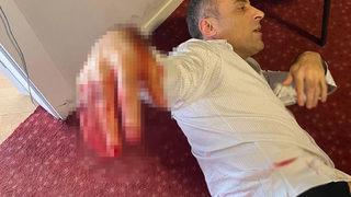 Son dakika: Yenilik Partisi Genel Başkanı Yılmaz'a bıçakla saldırmıştı! O şüpheli adliyeye sevk edildi