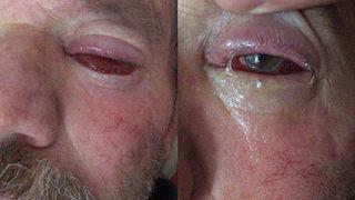 62 yaşında hayatının şokunu yaşadı Kör oldum çıktım Ameliyatlar bitmek bilmeyince...