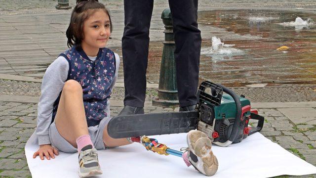 8 yıldır hukuk savaşı veriyor! Kızının protez bacağının üzerine motorlu testere koydu