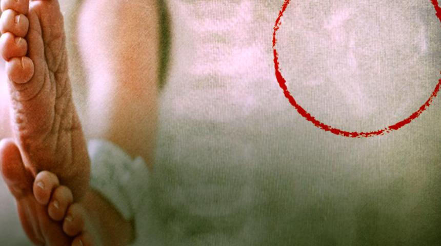 Son derece nadir görülüyor! İkizlerden biri kardeşinin midesinden bulundu... 500 binde bir görülüyor