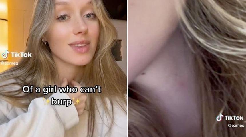 Hayatı boyunca bir kez bile geğirmedi! Sırf bunun için boynuna botoks yaptırınca...