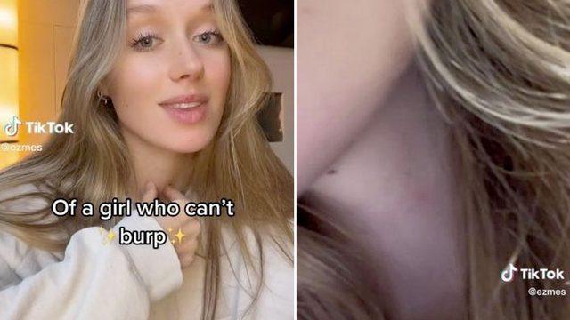 Hayatı boyunca bir kez bile geğirmedi! Sırf bunun için boynuna botoks yaptırınca...