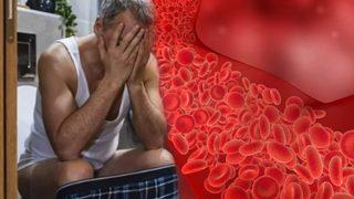 Ölümcül kan pıhtısının belirtisi tuvalette görülüyor! Durum çok ciddi olabilir