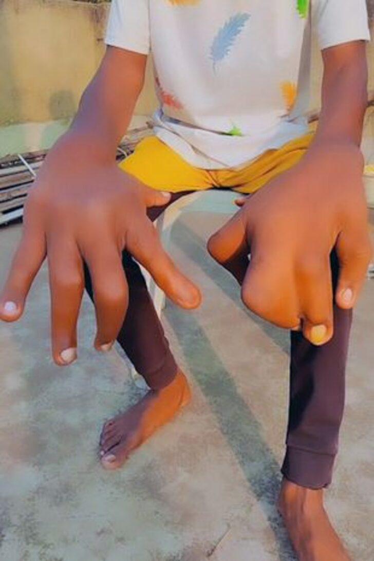 Son derece nadir görülüyor! Ellerinden sadece biri 8 kilo... Bir gören bir daha bakıyor G2