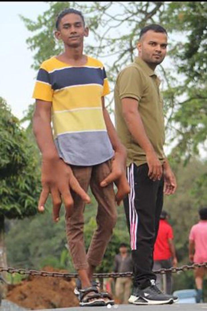 Son derece nadir görülüyor! Ellerinden sadece biri 8 kilo... Bir gören bir daha bakıyor G3