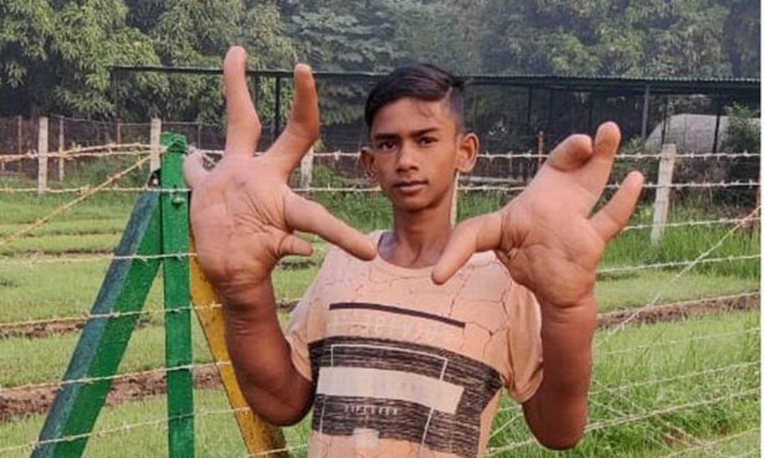 Son derece nadir g&ouml;r&uuml;l&uuml;yor! Ellerinden sadece biri 8 kilo... Bir g&ouml;ren bir daha bakıyor