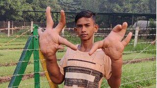 Son derece nadir görülüyor! Ellerinden sadece biri 8 kilo... Bir gören bir daha bakıyor