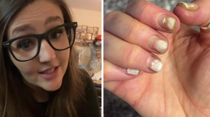 Manik&uuml;r yapmadan &ouml;nce tekrar d&uuml;ş&uuml;n&uuml;n! Başına gelenler g&ouml;z korkuttu